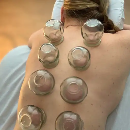 Fire Cupping